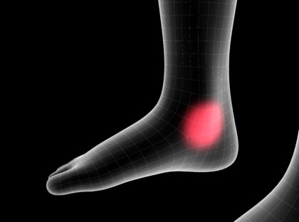 The Medial Ankle Sprain and What You Need to Know as an Athlete