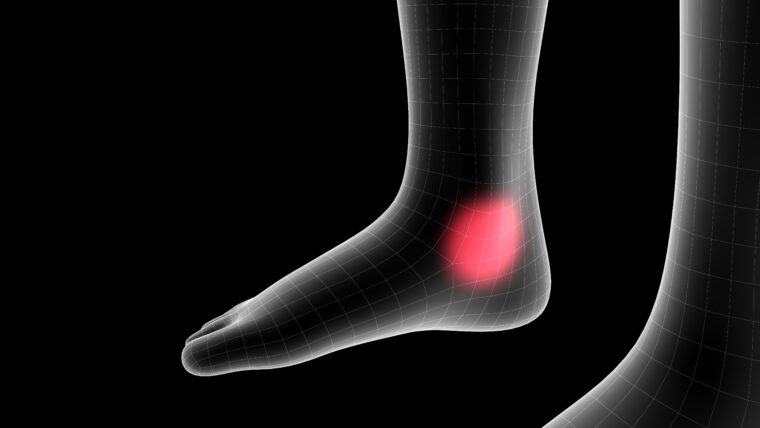 The Medial Ankle Sprain and What You Need to Know as an Athlete